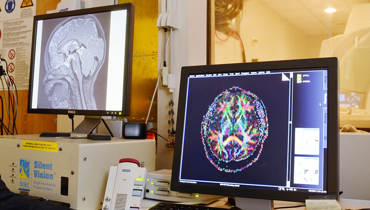 Brain scans are shown on two comptuer screens.