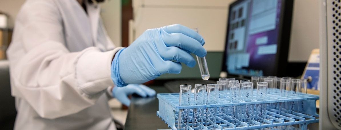 A doctor holds a test tube.
