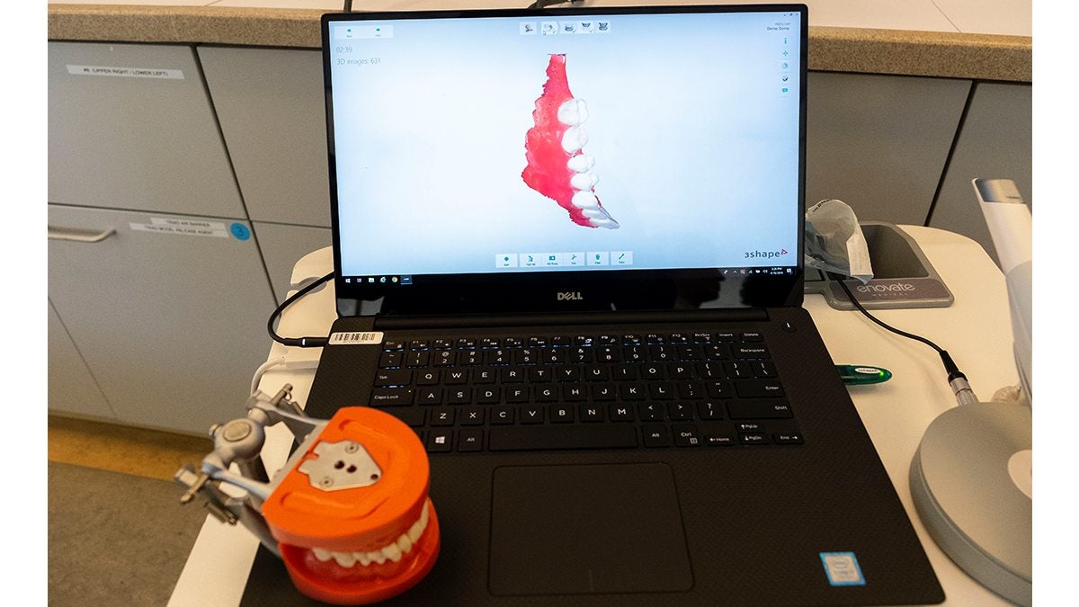 A model of teeth on a laptop.
